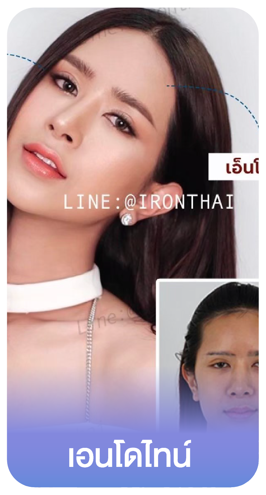 Slide แยก -15