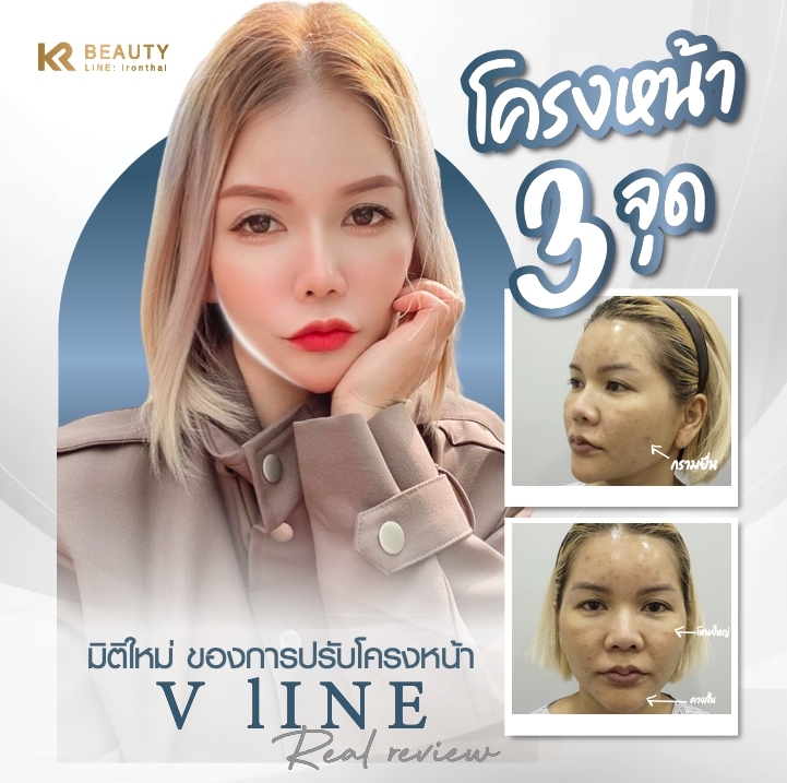 LINE_ALBUM_3 points contouring_240220_1