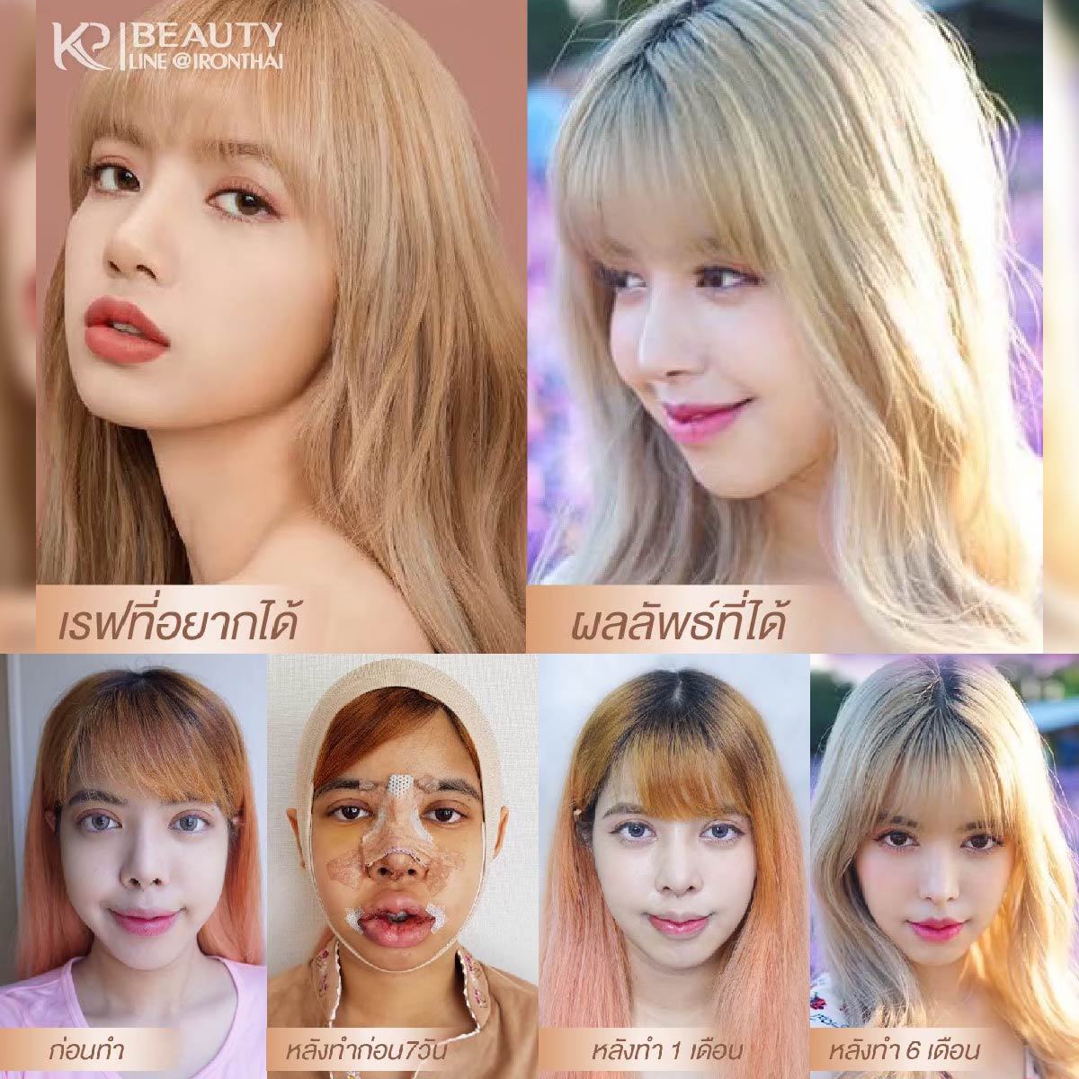 album template-12