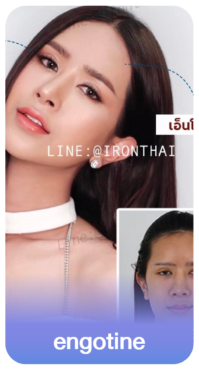 Slide แยก -15