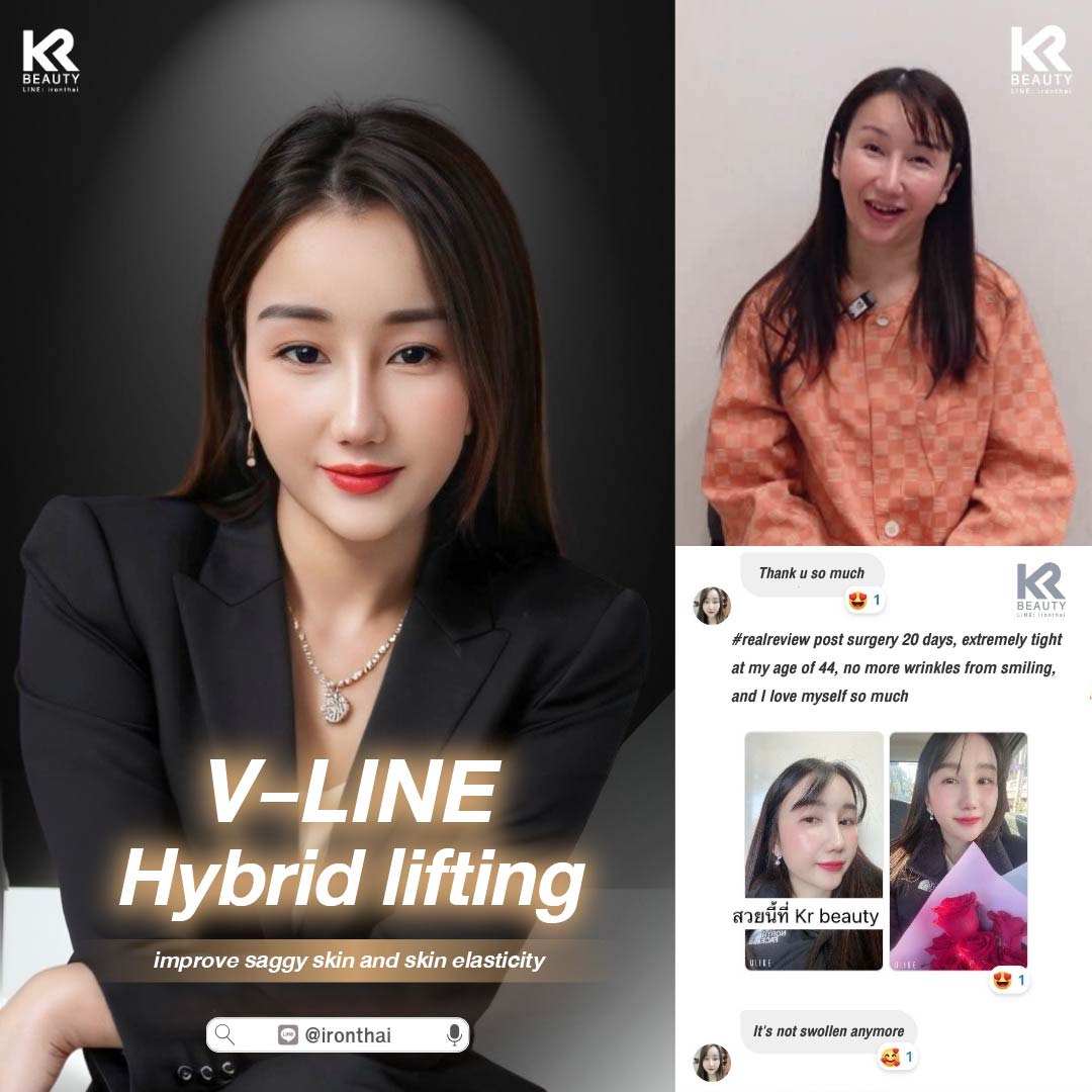 Eng_hybrid lifting-02